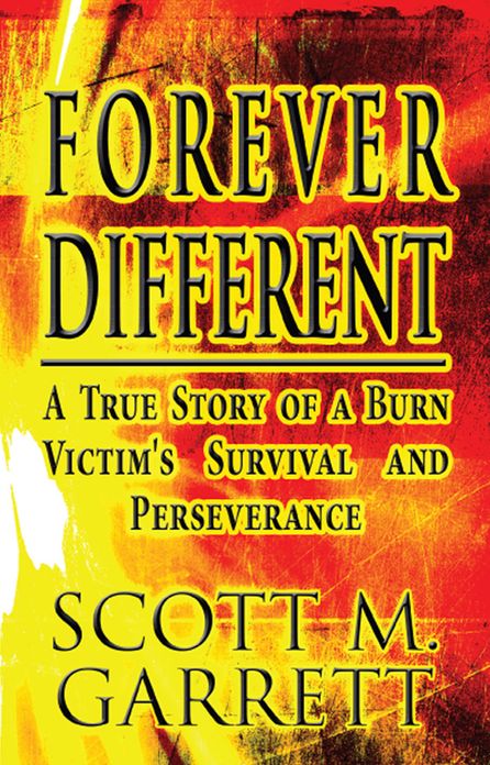 Forever Different: A True Story of a Burn Victim's Survival and Perseverance