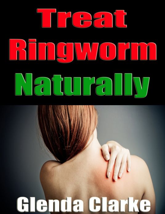 Treat Ringworm Naturally