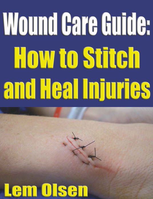 Wound Care Guide: How to Stitch and Heal Injuries