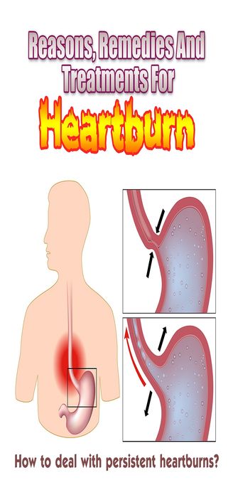 Reasons, Remedies And Treatments For Heartburn