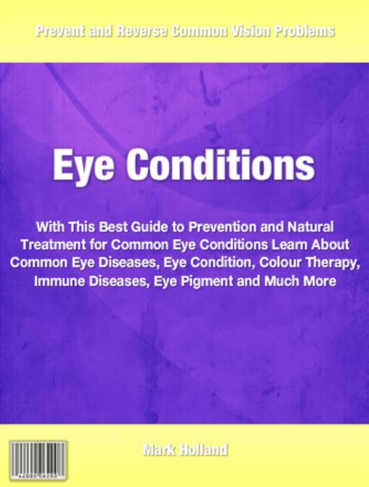 Eye Condition: With This Best Guide to Prevention and Natural Treatment for Common Eye Conditions Learn About Common Eye Diseases, Eye Condition, Colour Therapy, Immune Diseases, Eye Pigment and Much More
