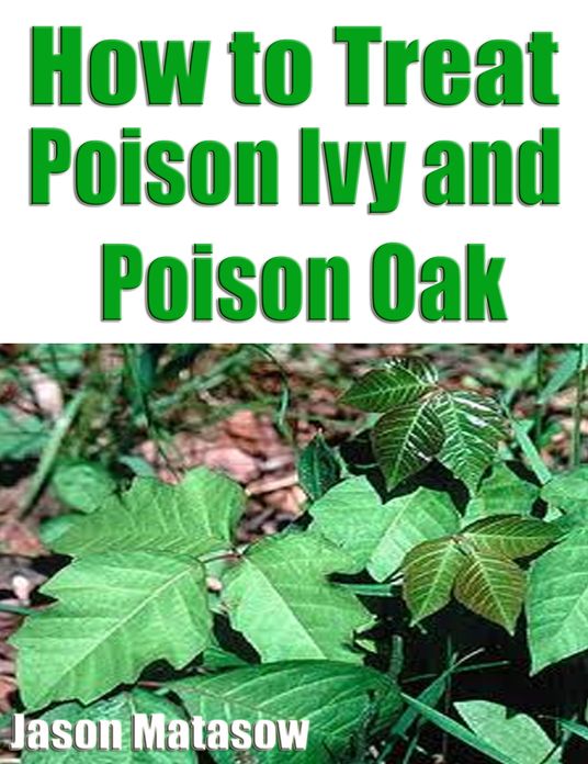 How to Treat Poison Ivy and Poison Oak