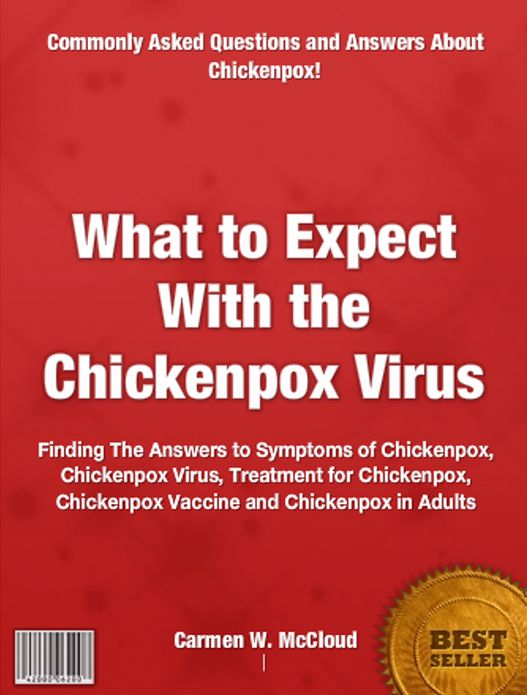 What to Expect With the Chickenpox Virus: Finding The Answers to Symptoms of Chickenpox, Chickenpox Virus, Treatment for Chickenpox, Chickenpox Vaccine and Chickenpox in Adults