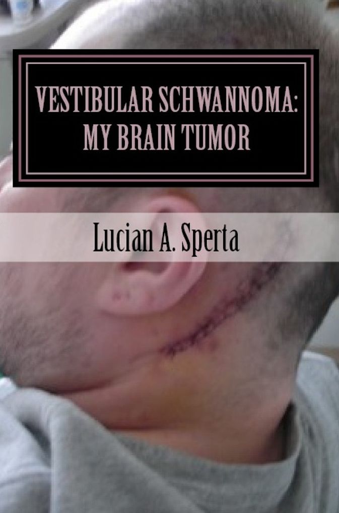 Vestibular Schwannoma: My Brain Tumor