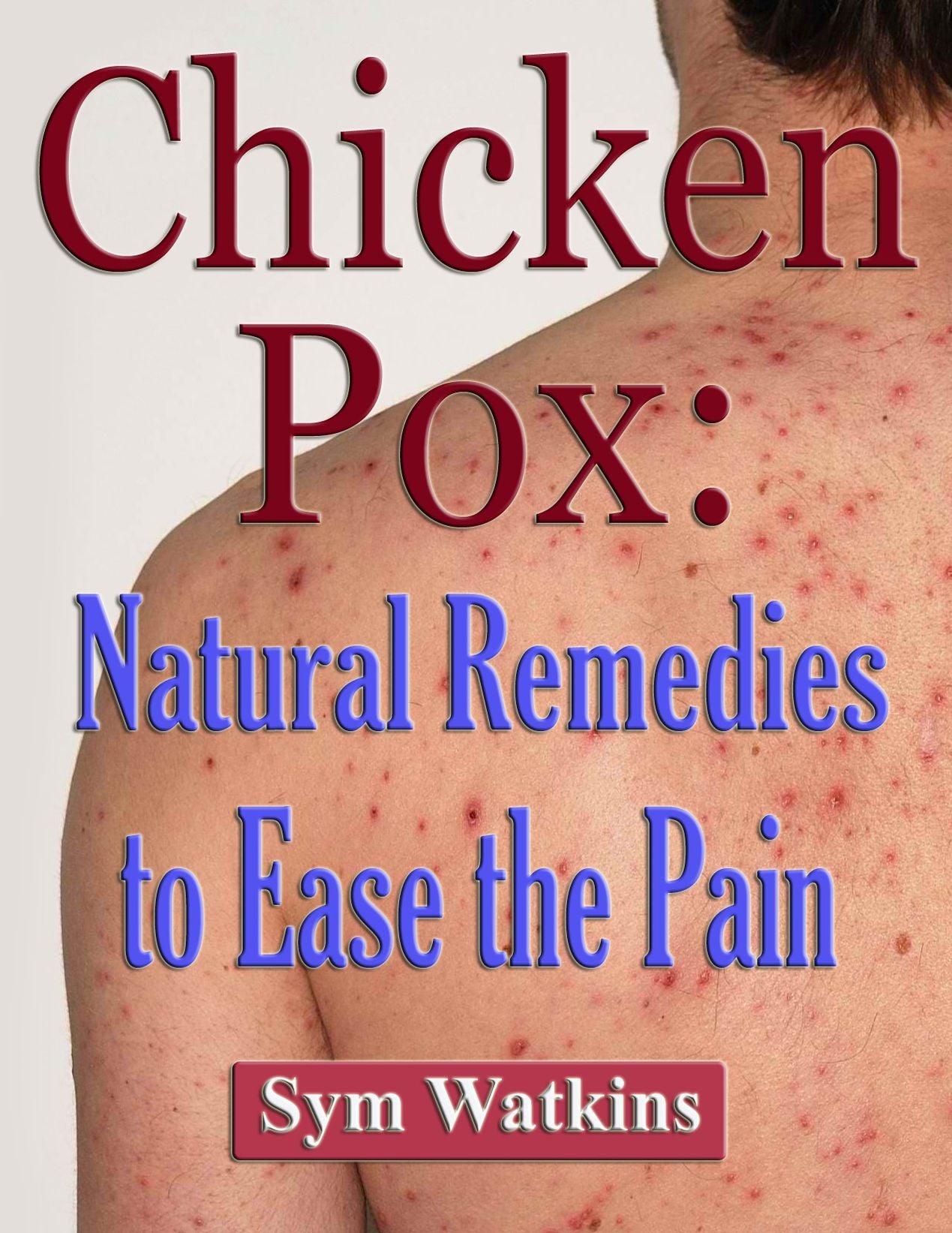 Chicken Pox: Natural Remedies to Ease the Pain