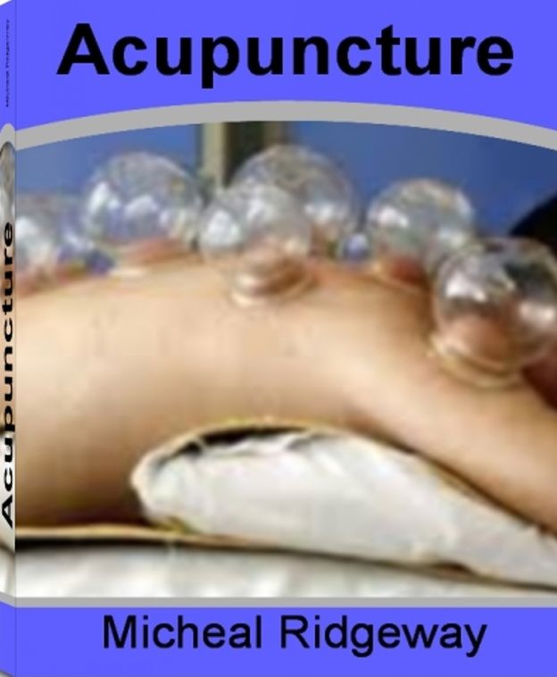Acupuncture: The Nation's Most Influential Sourcebook On Acupuncture Points, Acupuncture and Fertility, Acupuncture Stop Smoking, Acupuncture Depression, Acupuncture Back Pain and More