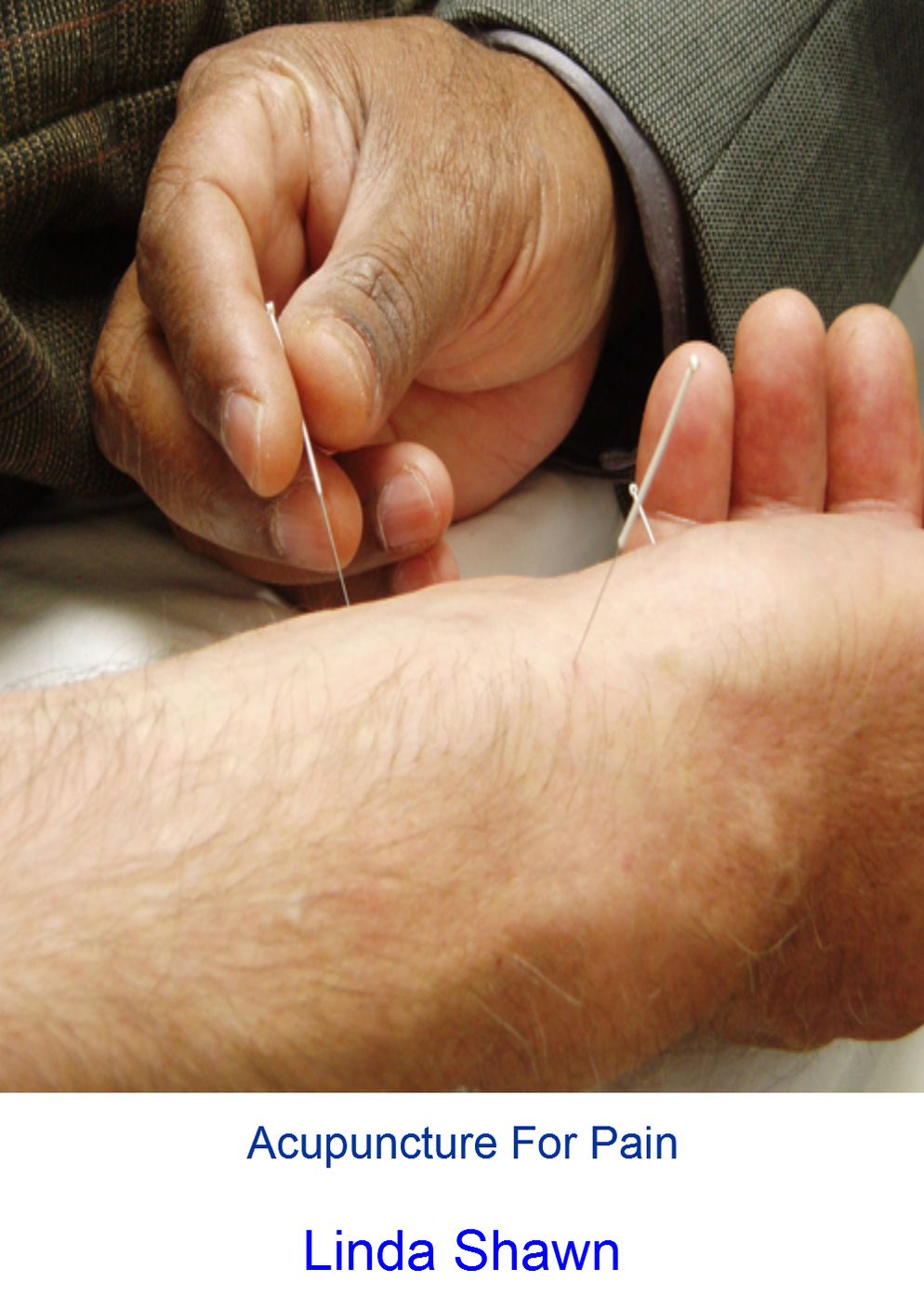 Acupuncture For Pain