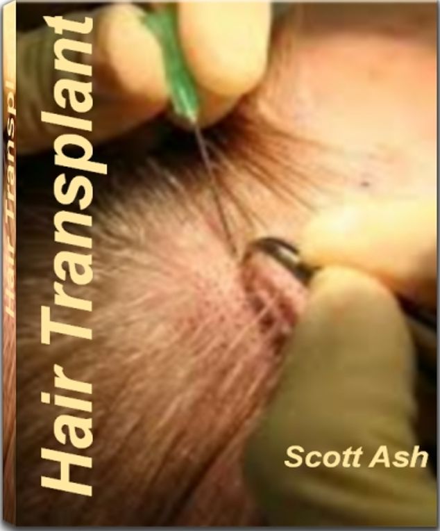 Hair Transplant: A Practical Guide For Hair Multiplication, Baldness Cure and Much More