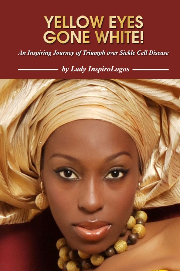 YELLOW EYES GONE WHITE! An Inspiring Journey of Triumph over Sickle Cell Disease