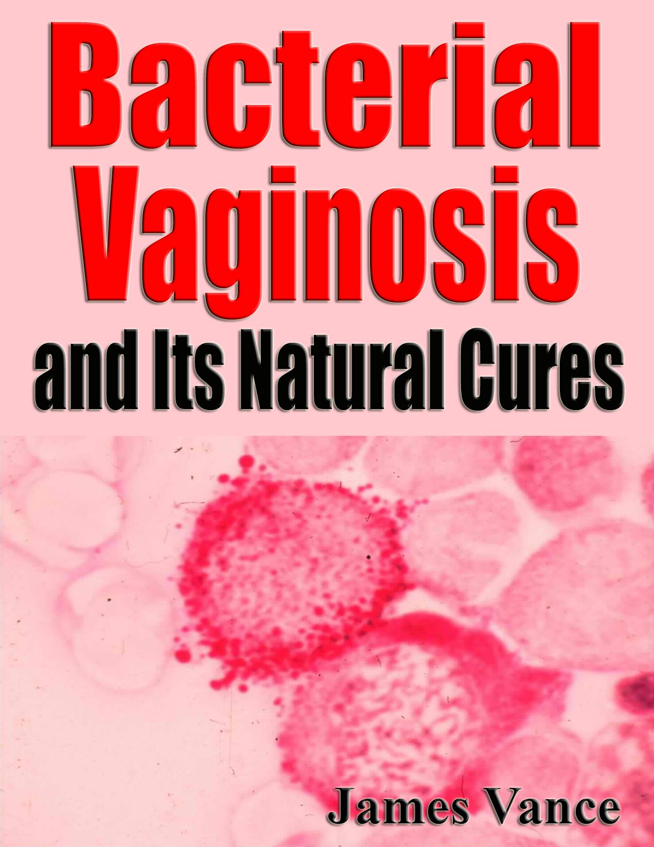 Bacterial Vaginosis and Its Natural Cures