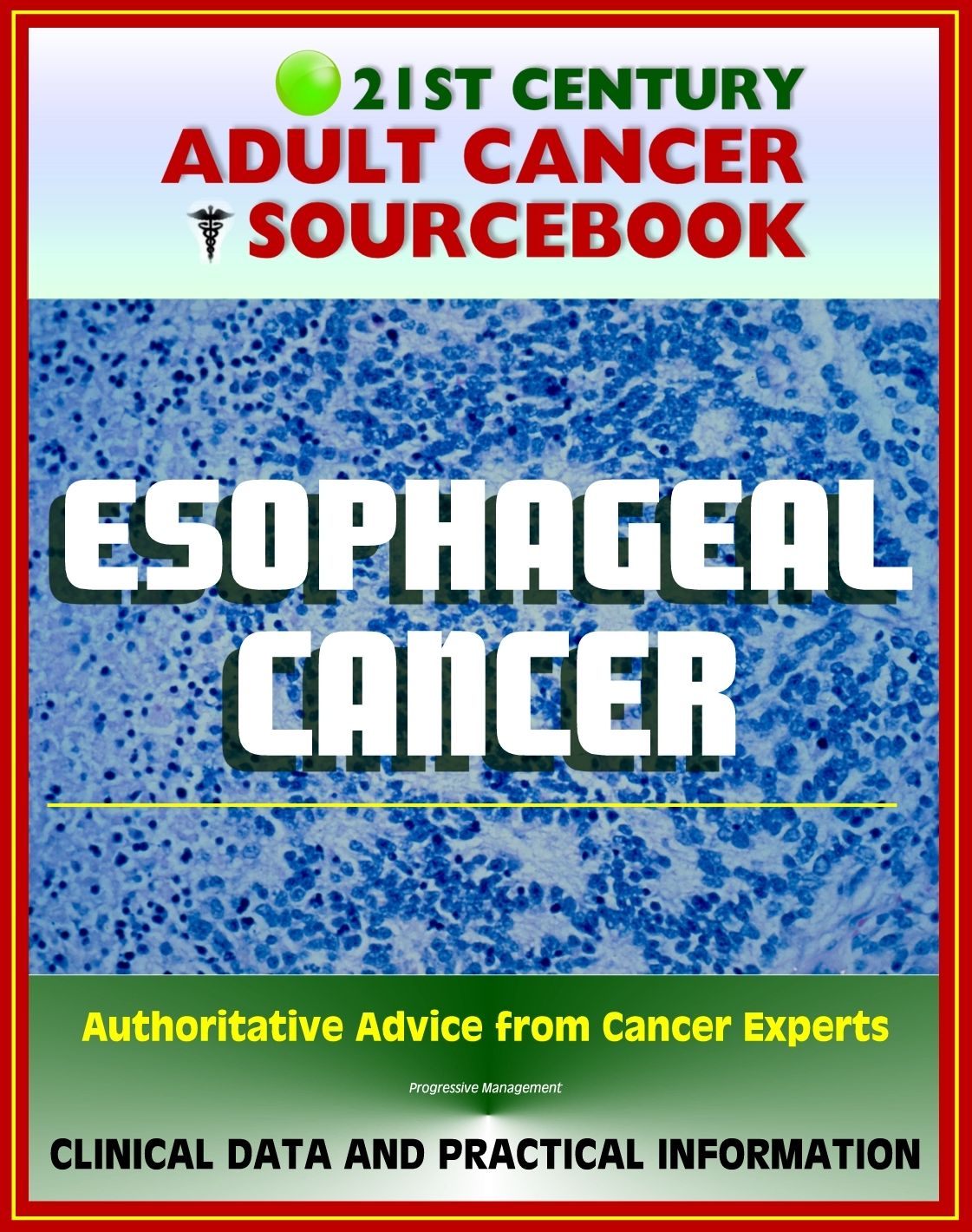 21st Century Adult Cancer Sourcebook: Esophageal Cancer (Cancer of the Esophagus) - Clinical Data for Patients, Families, and Physicians