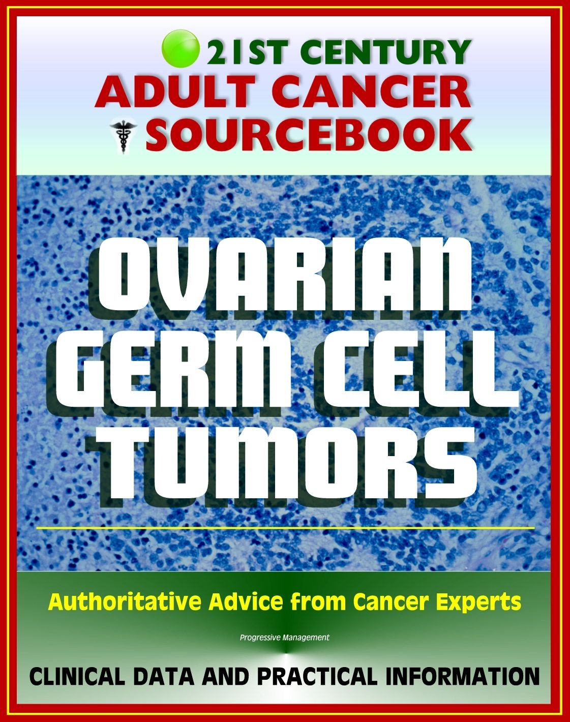 21st Century Adult Cancer Sourcebook: Ovarian Germ Cell Tumors - Clinical Data for Patients, Families, and Physicians