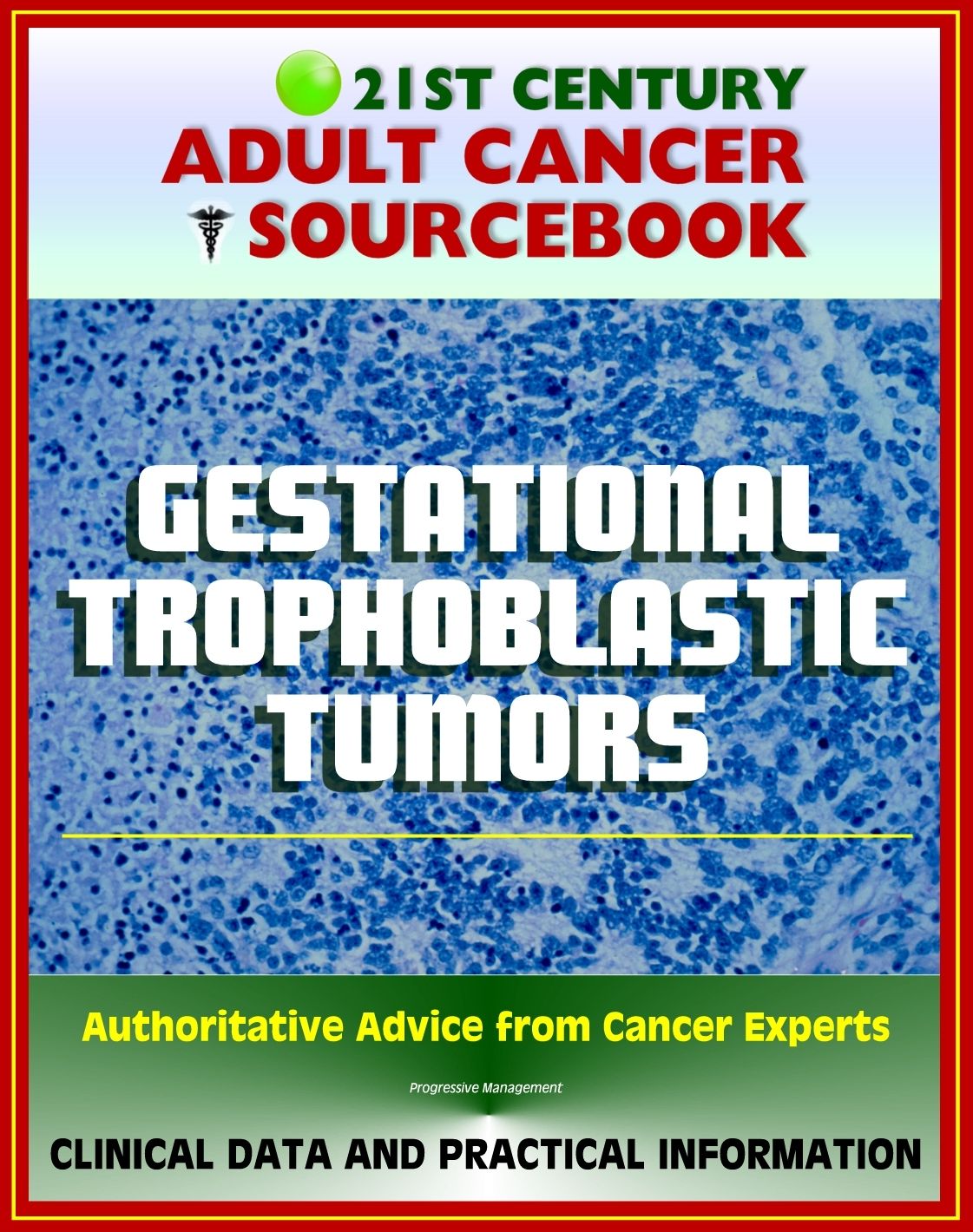 21st Century Adult Cancer Sourcebook: Gestational Trophoblastic Tumors, Hydatidiform Mole, Choriocarcinoma, GTD, GTT, GTN, PSTT - Clinical Data for Patients, Families, and Physicians