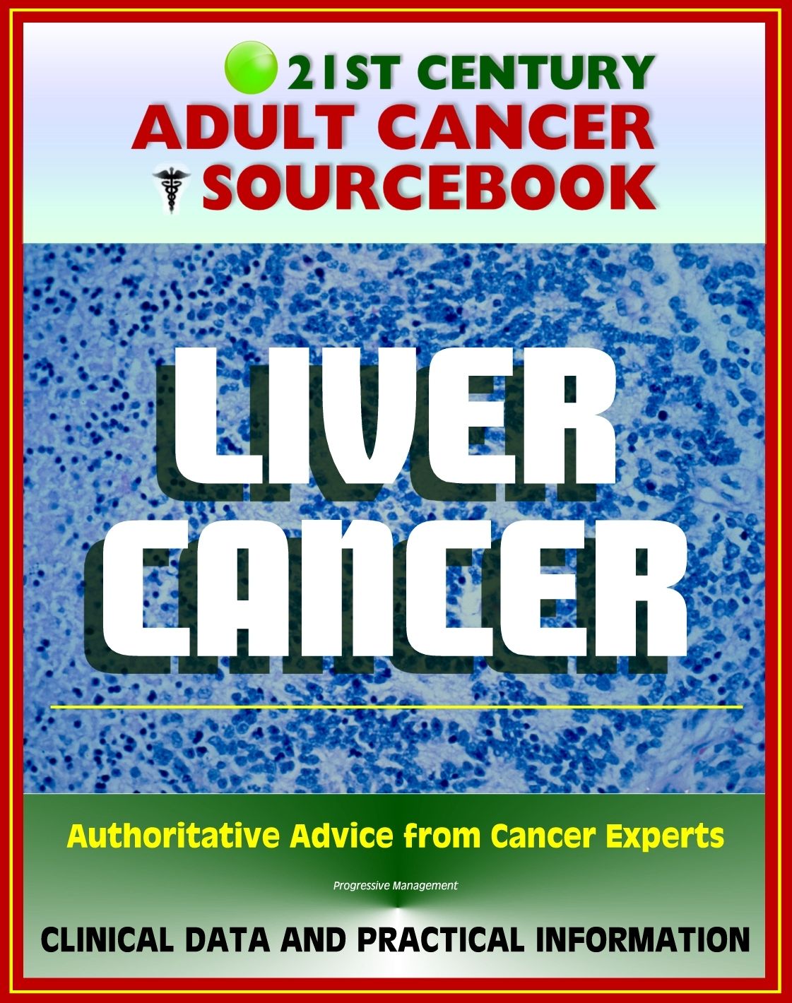 21st Century Adult Cancer Sourcebook: Liver Cancer, Hepatocellular Carcinoma (HCC) - Clinical Data for Patients, Families, and Physicians