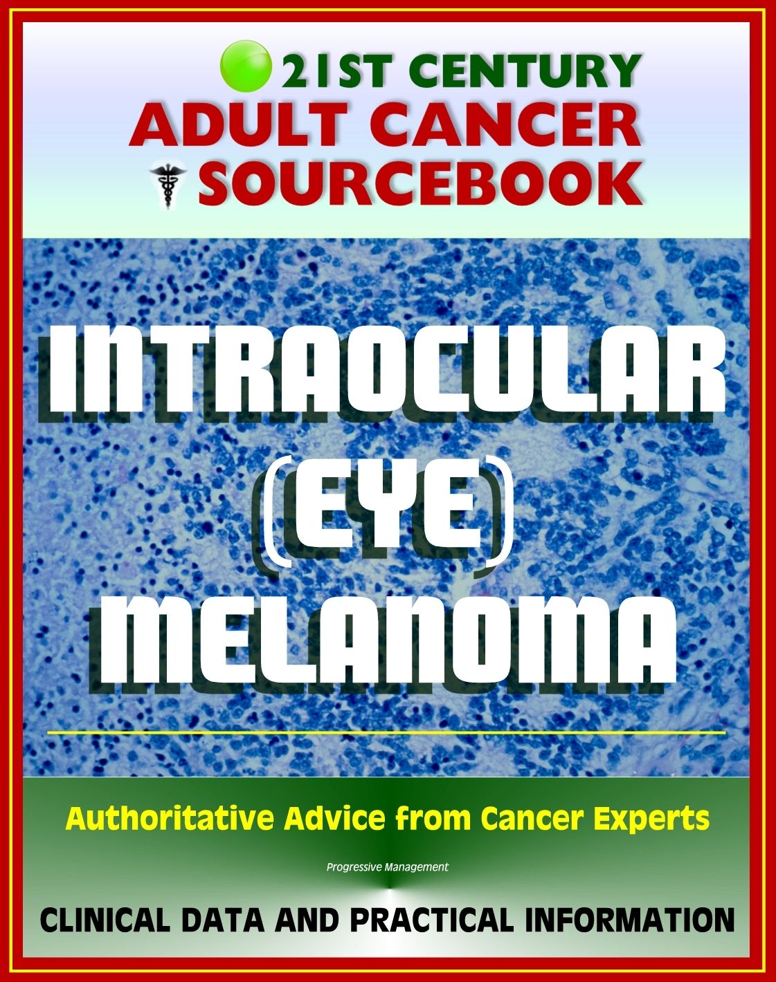 21st Century Adult Cancer Sourcebook: Intraocular (Eye) Melanoma - Clinical Data for Patients, Families, and Physicians
