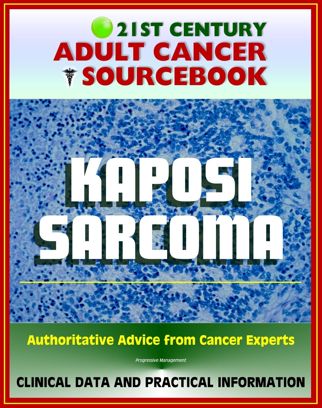 21st Century Adult Cancer Sourcebook: Kaposi Sarcoma - Clinical Data for Patients, Families, and Physicians
