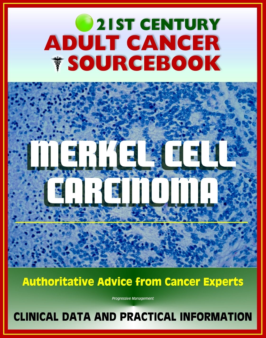 21st Century Adult Cancer Sourcebook: Merkel Cell Carcinoma (MCC) - Clinical Data for Patients, Families, and Physicians