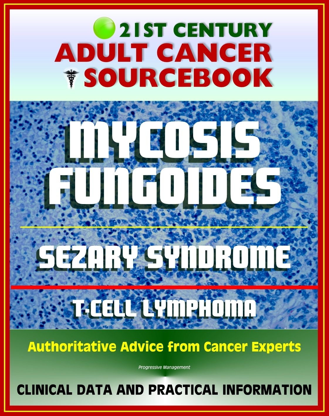 21st Century Adult Cancer Sourcebook: Mycosis Fungoides and the Sezary Syndrome, Cutaneous T-cell Lymphoma. - Clinical Data for Patients, Families, and Physicians