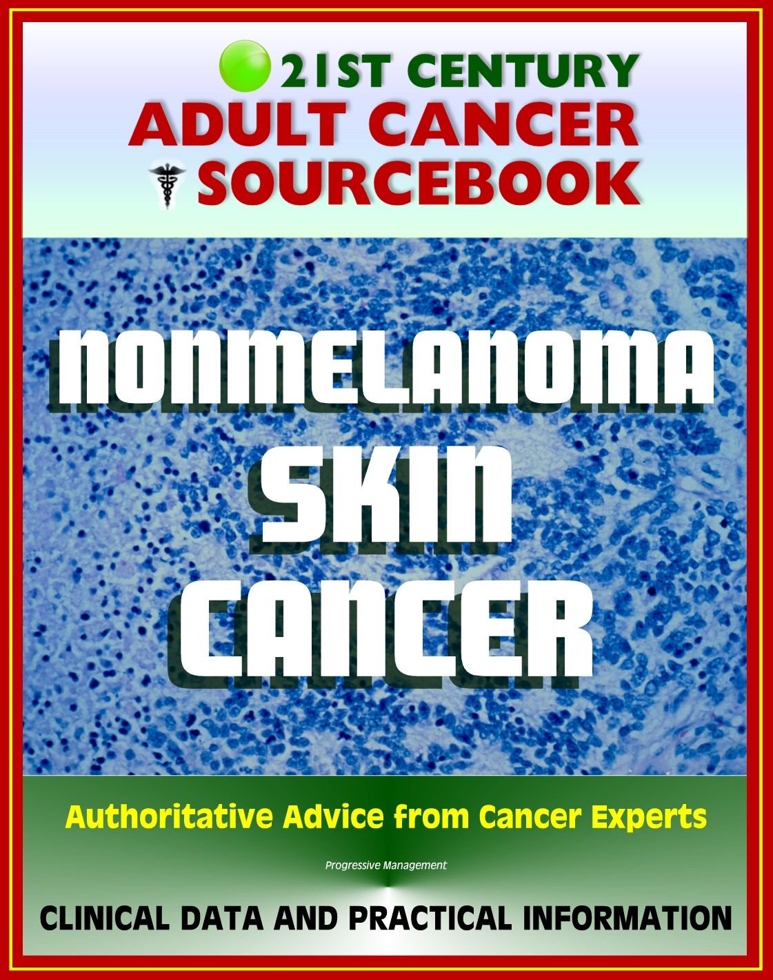 21st Century Adult Cancer Sourcebook: Nonmelanoma Skin Cancer - Squamous Cell Carcinoma and Basal Cell Carcinoma (BCC and SCC) - Clinical Data for Patients, Families, and Physicians