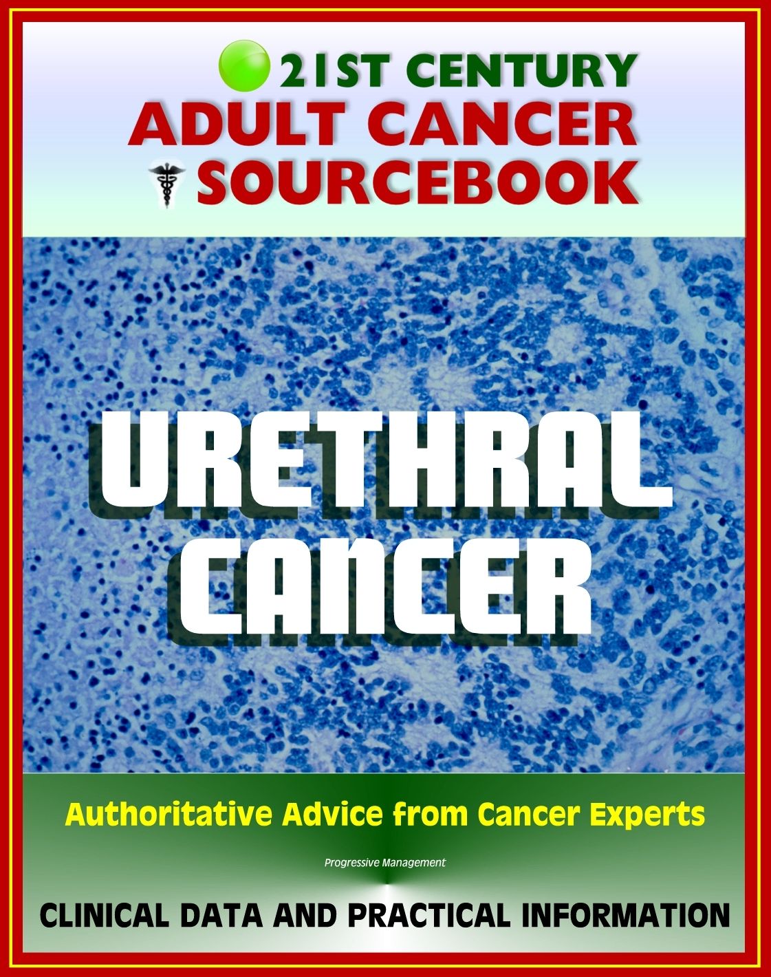 21st Century Adult Cancer Sourcebook: Urethral Cancer (Cancer of the Urethra) - Clinical Data for Patients, Families, and Physicians