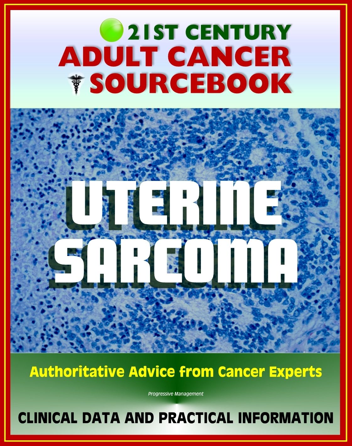 21st Century Adult Cancer Sourcebook: Uterine Sarcoma - Clinical Data for Patients, Families, and Physicians