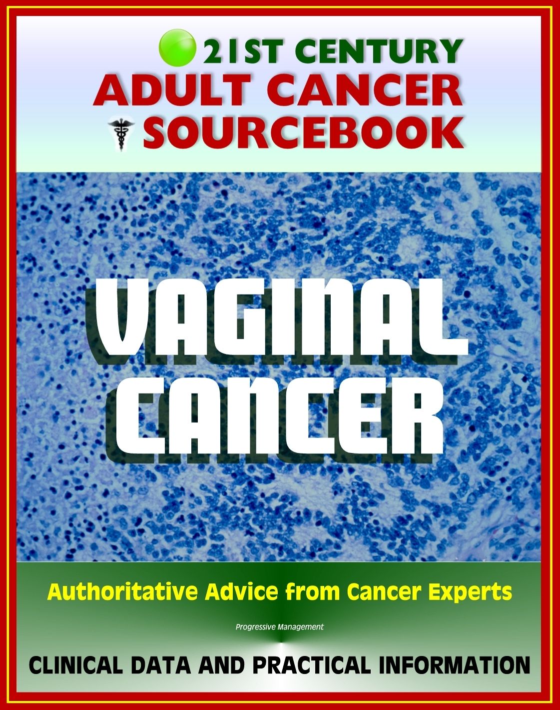 21st Century Adult Cancer Sourcebook: Vaginal Cancer - Clinical Data for Patients, Families, and Physicians