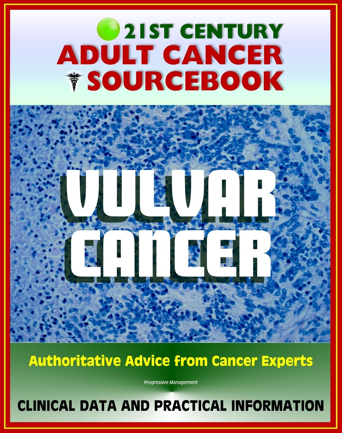 21st Century Adult Cancer Sourcebook: Vulvar Cancer - Clinical Data for Patients, Families, and Physicians