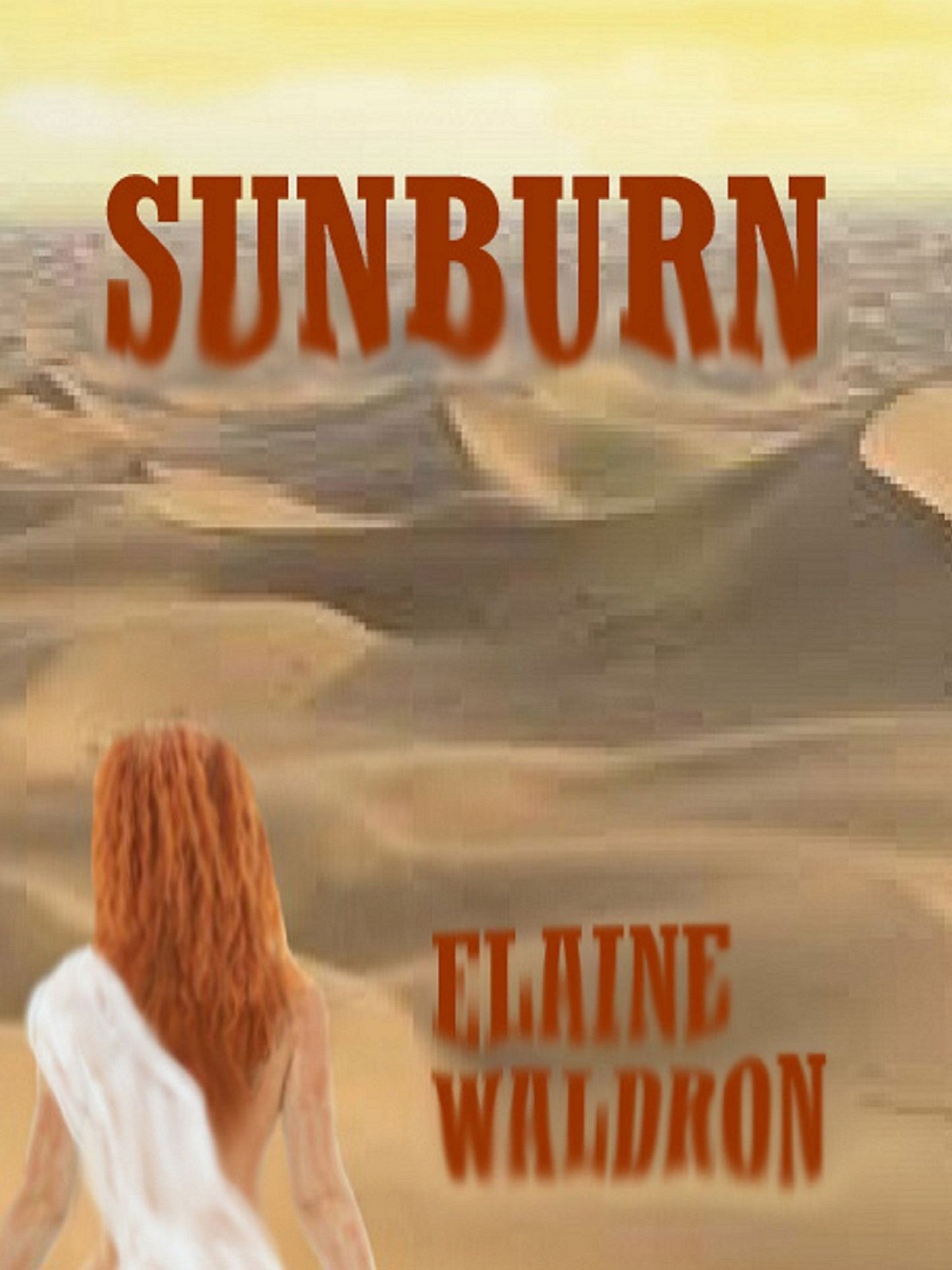 Sunburn