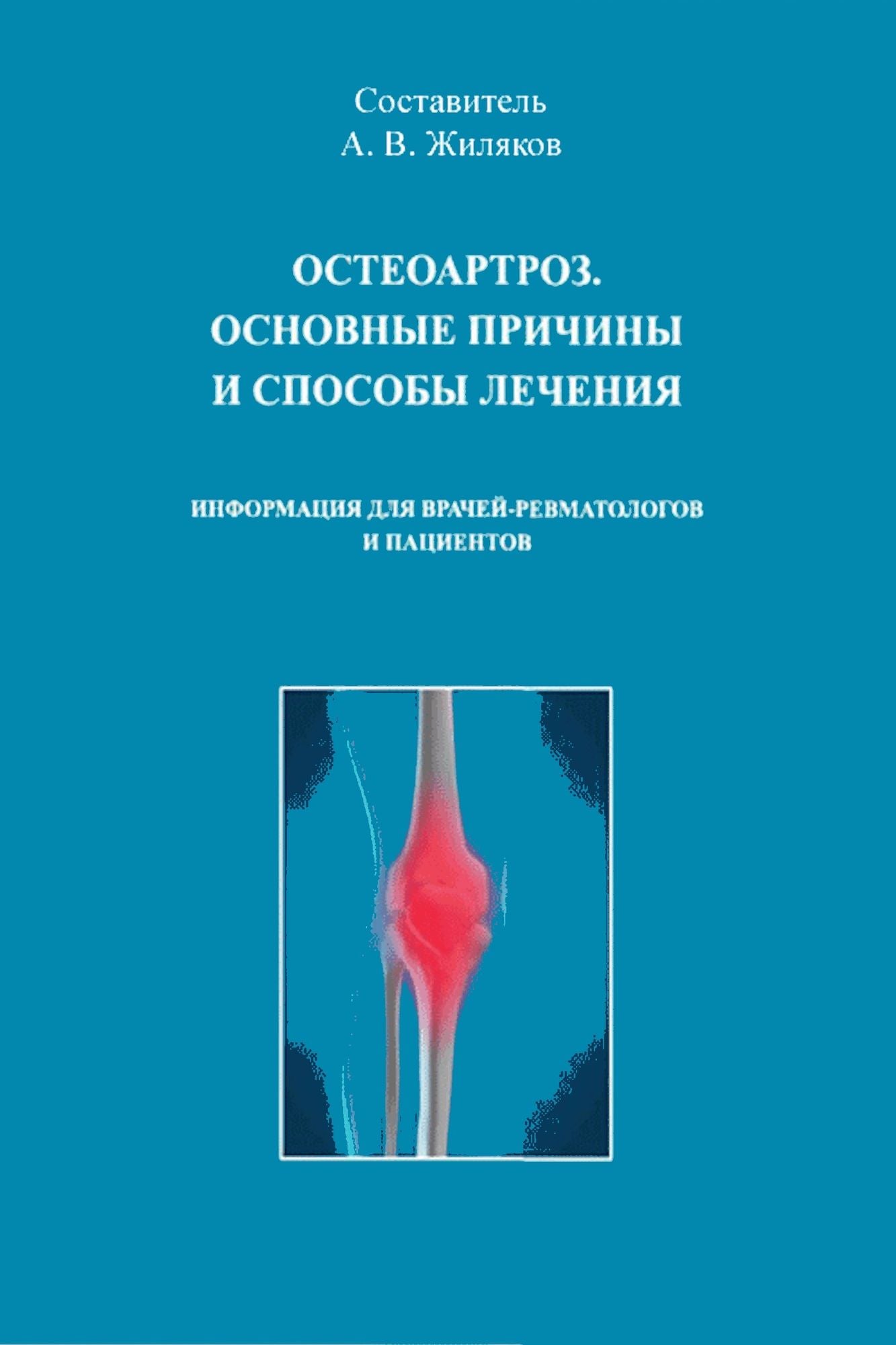 Osteoartroz. Osnovnye priciny i sposoby lecenia