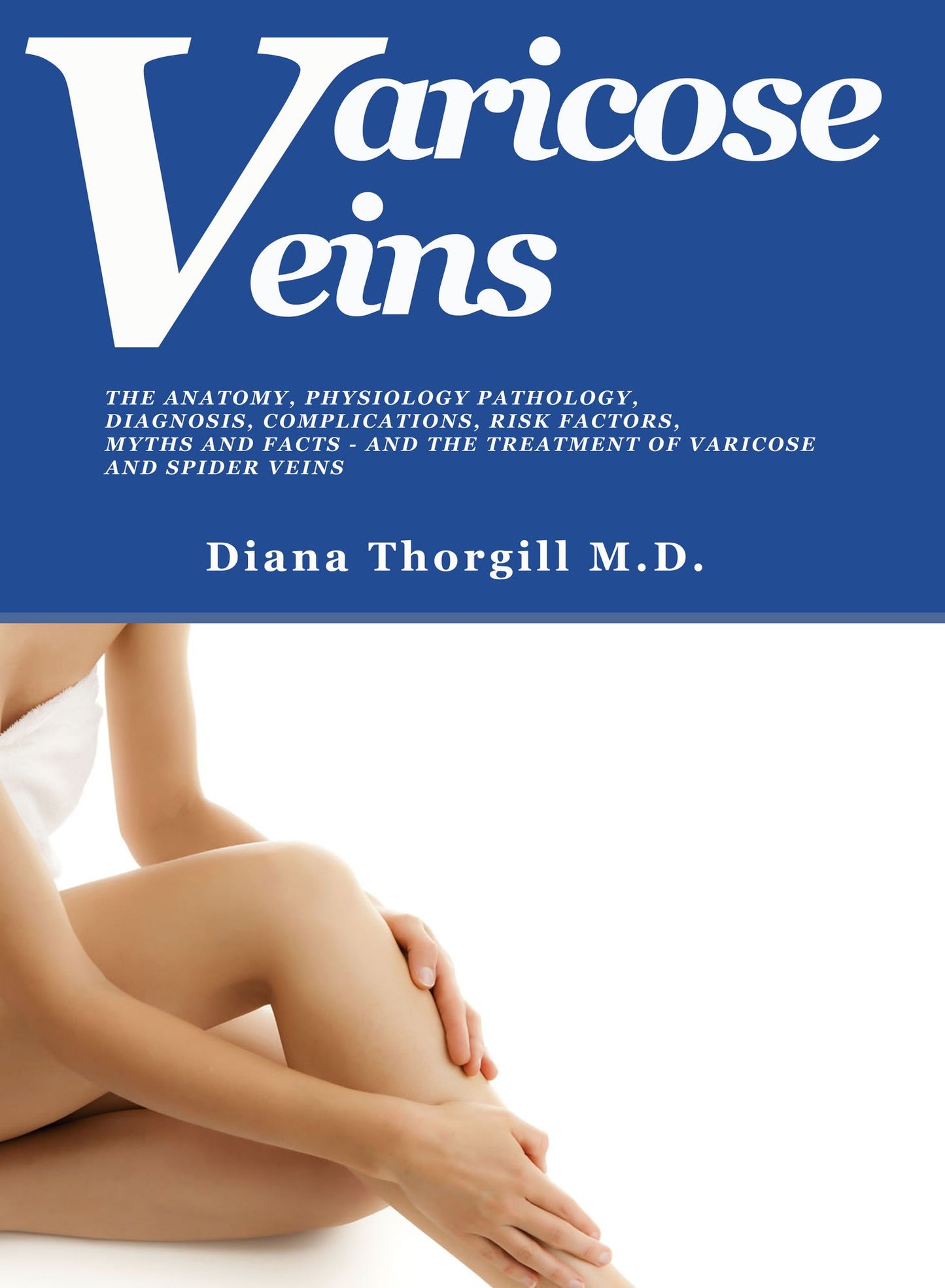 Varicose Veins: The Anatomy, Physiology Pathology, Diagnosis, Complications, Risk Factors, Myths and Facts and the Treatment of Varicose and Spider Veins