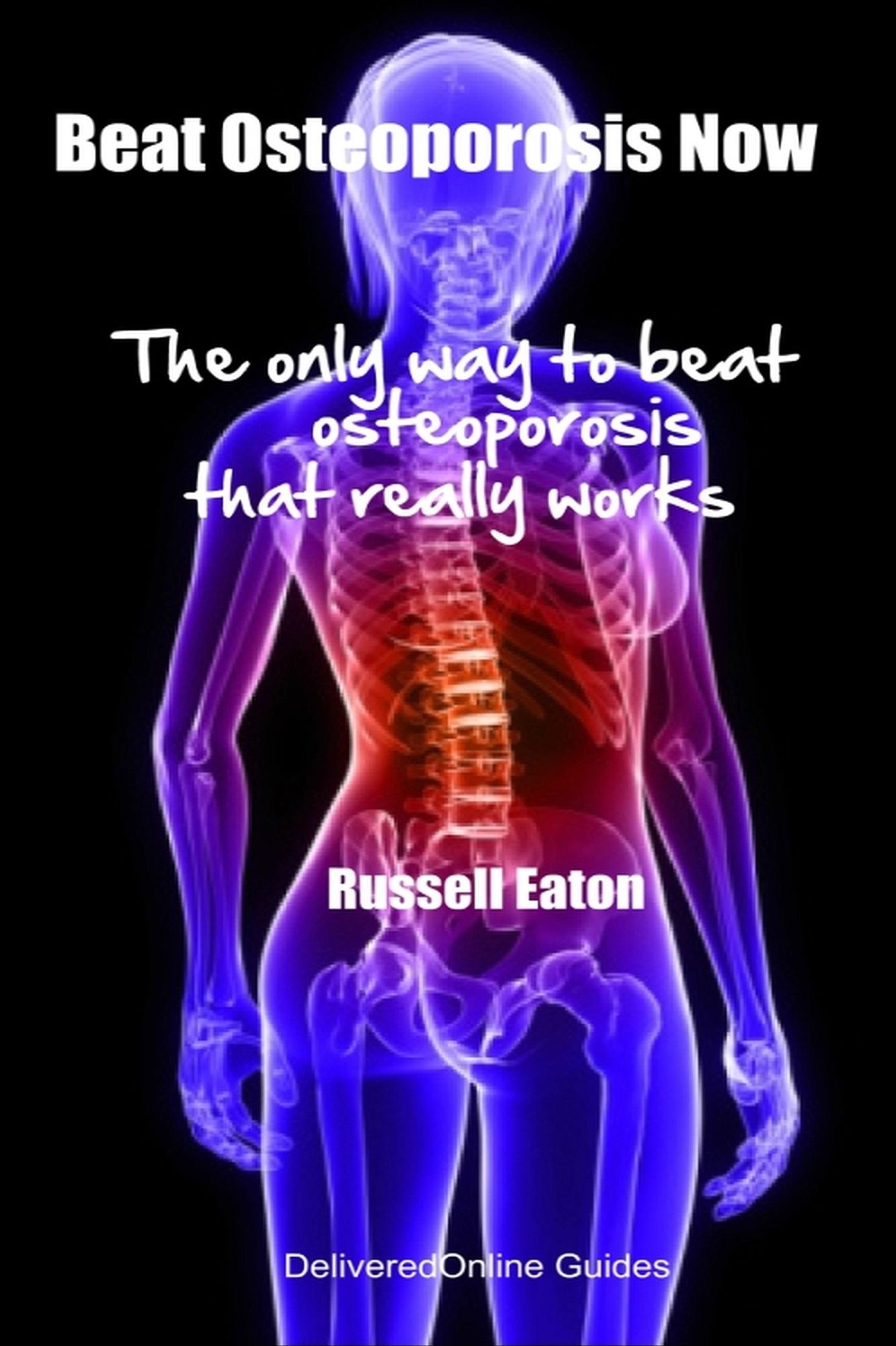 Beat Osteoporosis Now