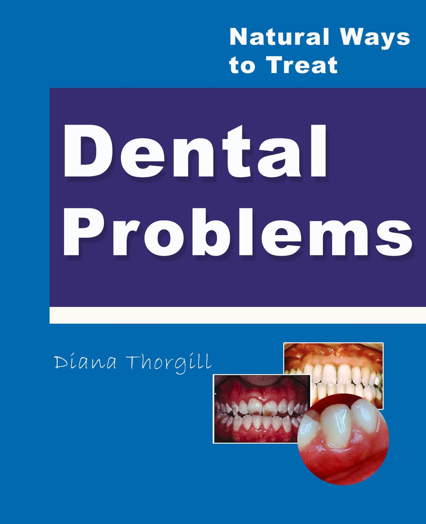 Natural Ways to Treat Dental Problems