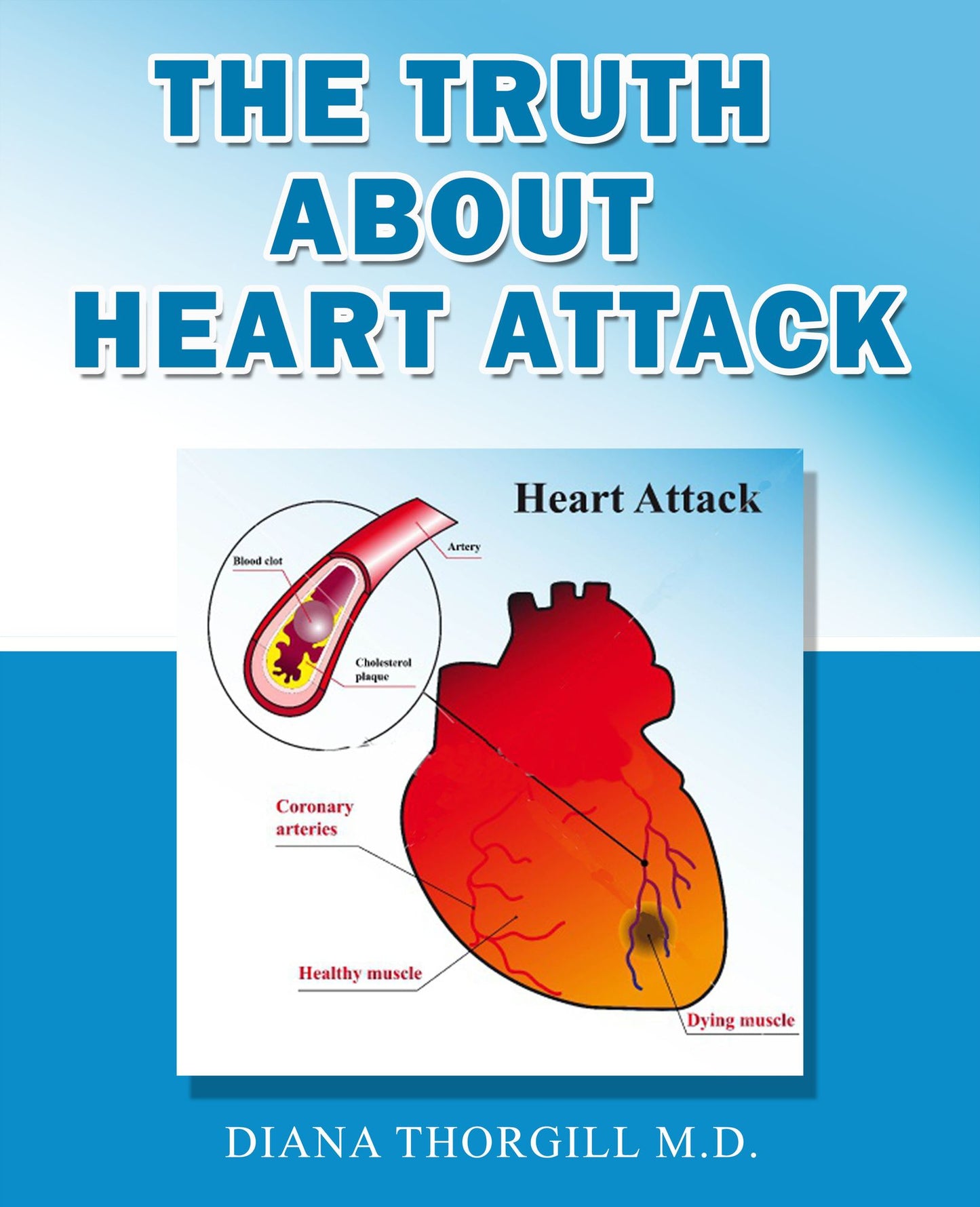 The Truth About Heart Attack: All You Need to Know about Heart Attack and How it is treated