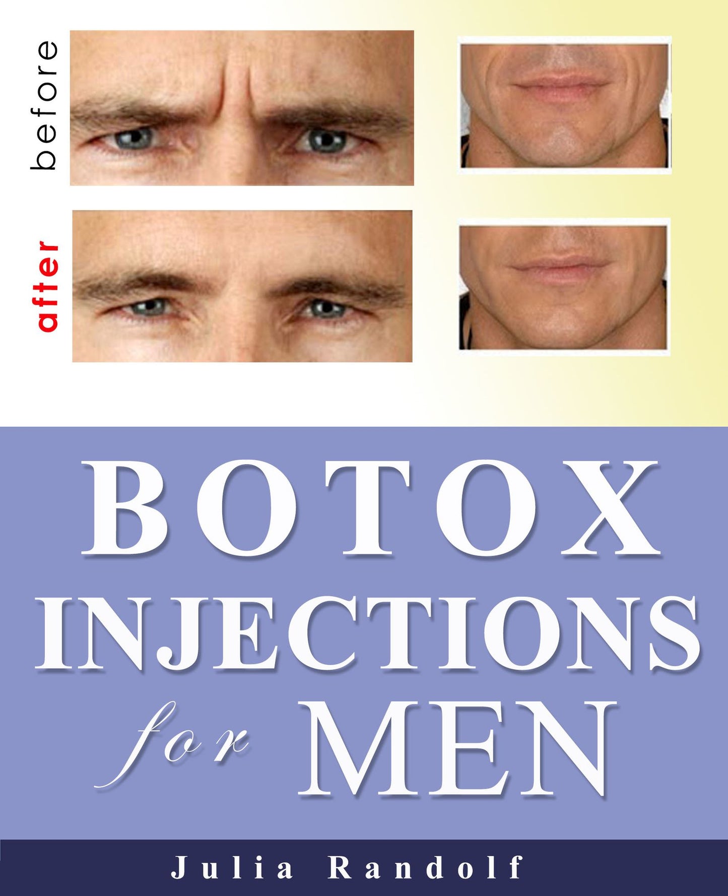 Botox Injections for Men Having Wrinkles