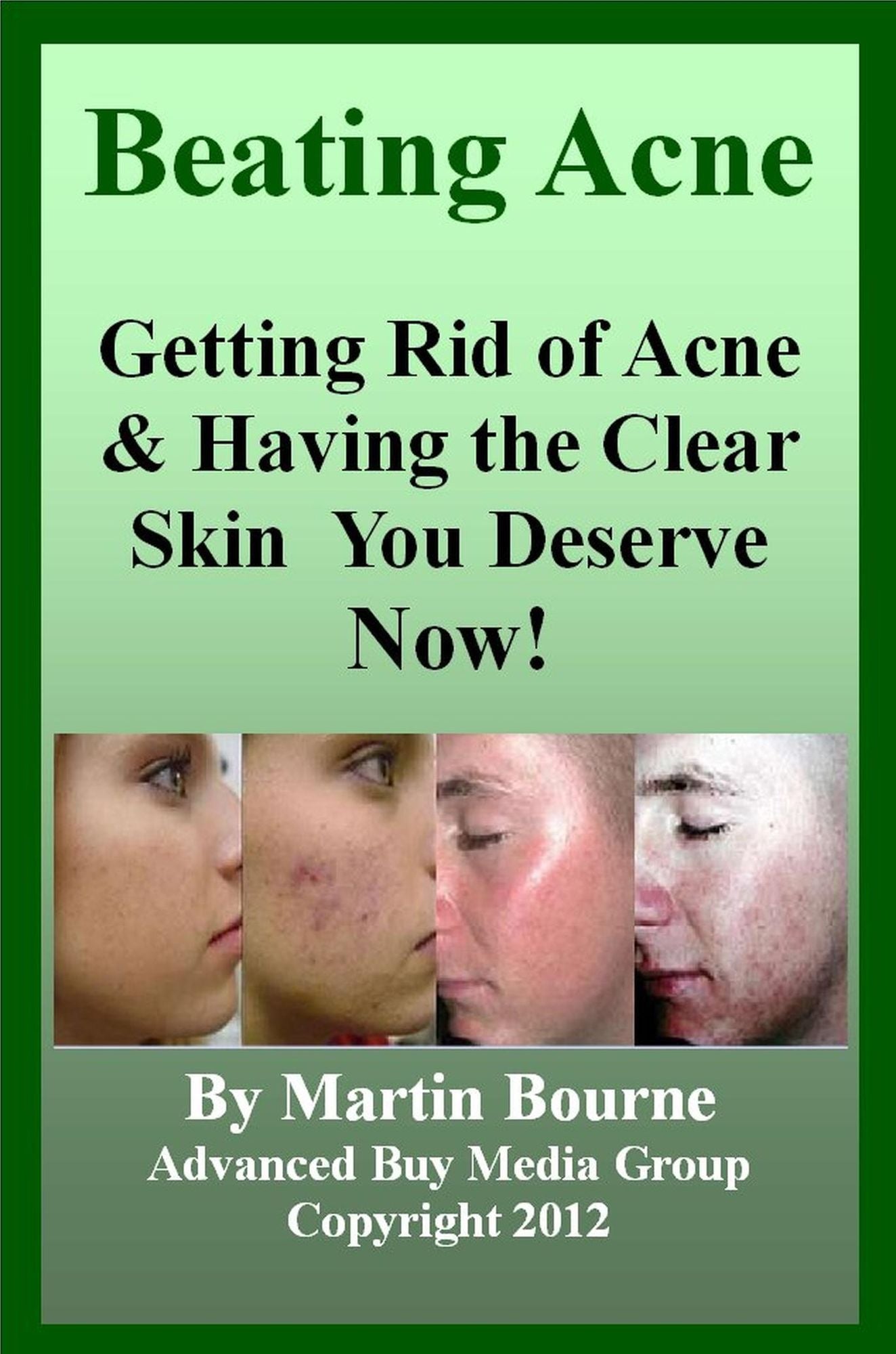 Beating Acne: Getting Rid of Acne & Having the Skin You Deserve Now!
