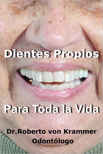 Dientes Propios Para Toda la Vida