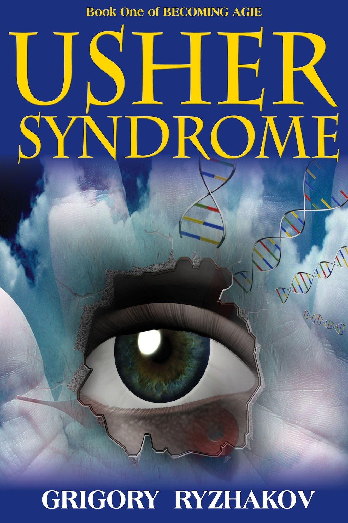 Usher Syndrome