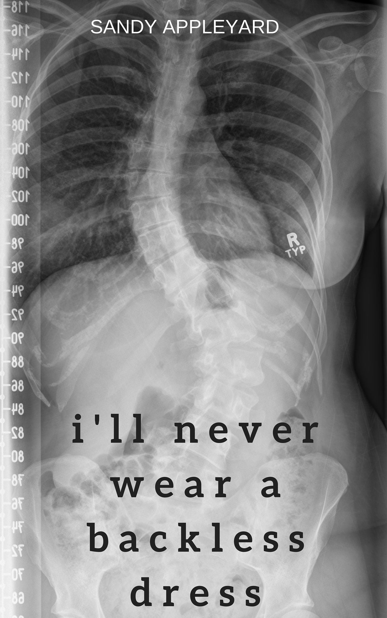 I'll Never Wear a Backless Dress