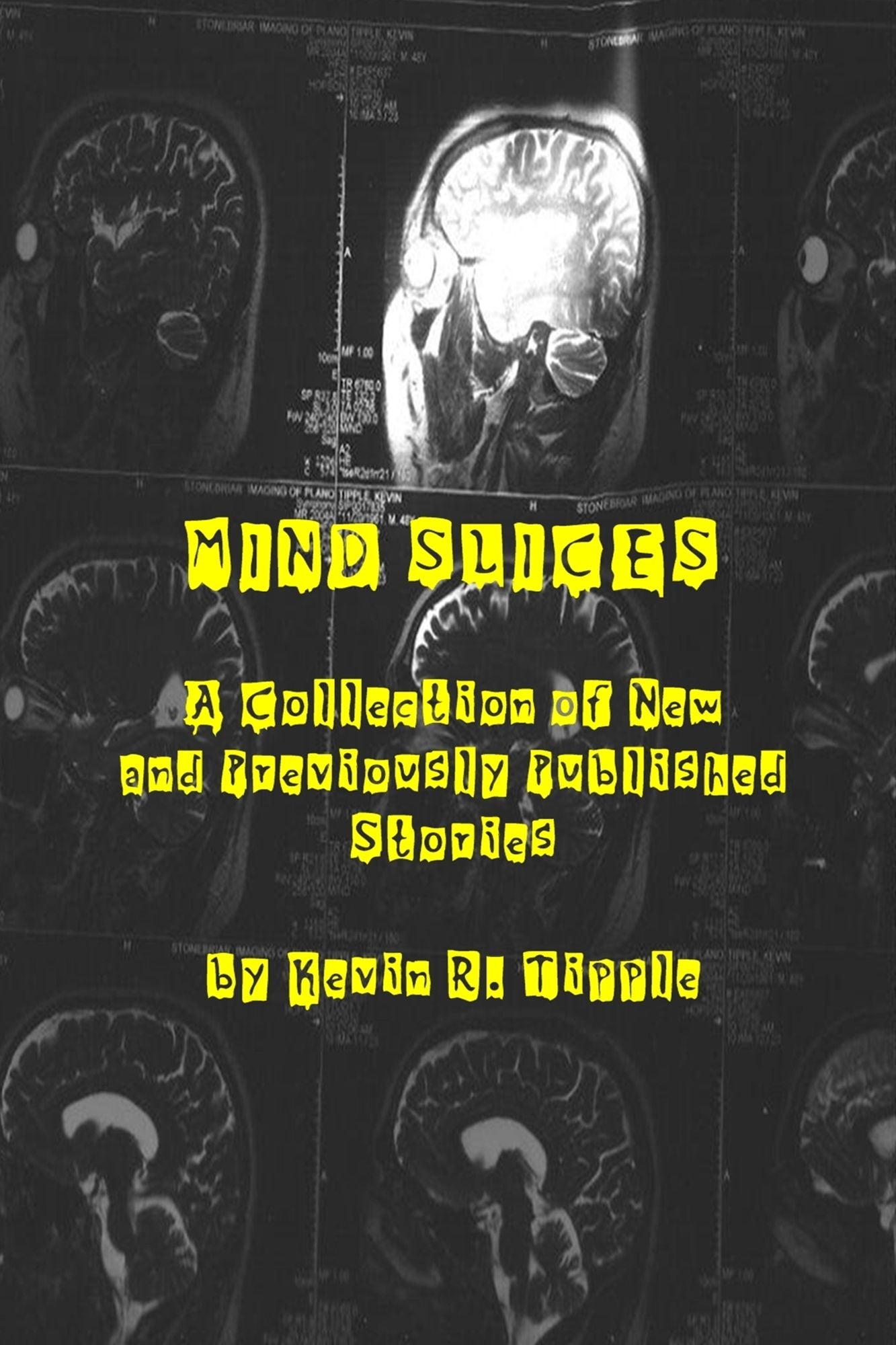 Mind Slices: A Collection of New and Previously Published Stories