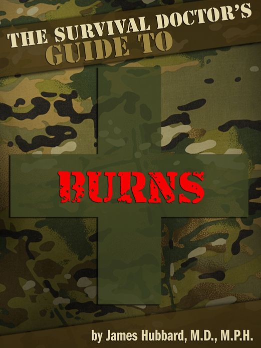 The Survival Doctor's Guide to Burns