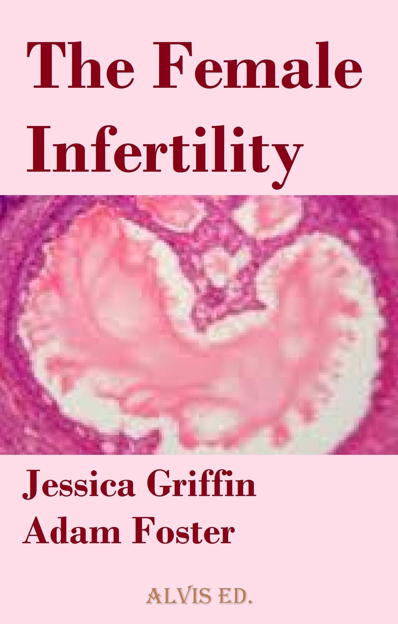The Female Infertility