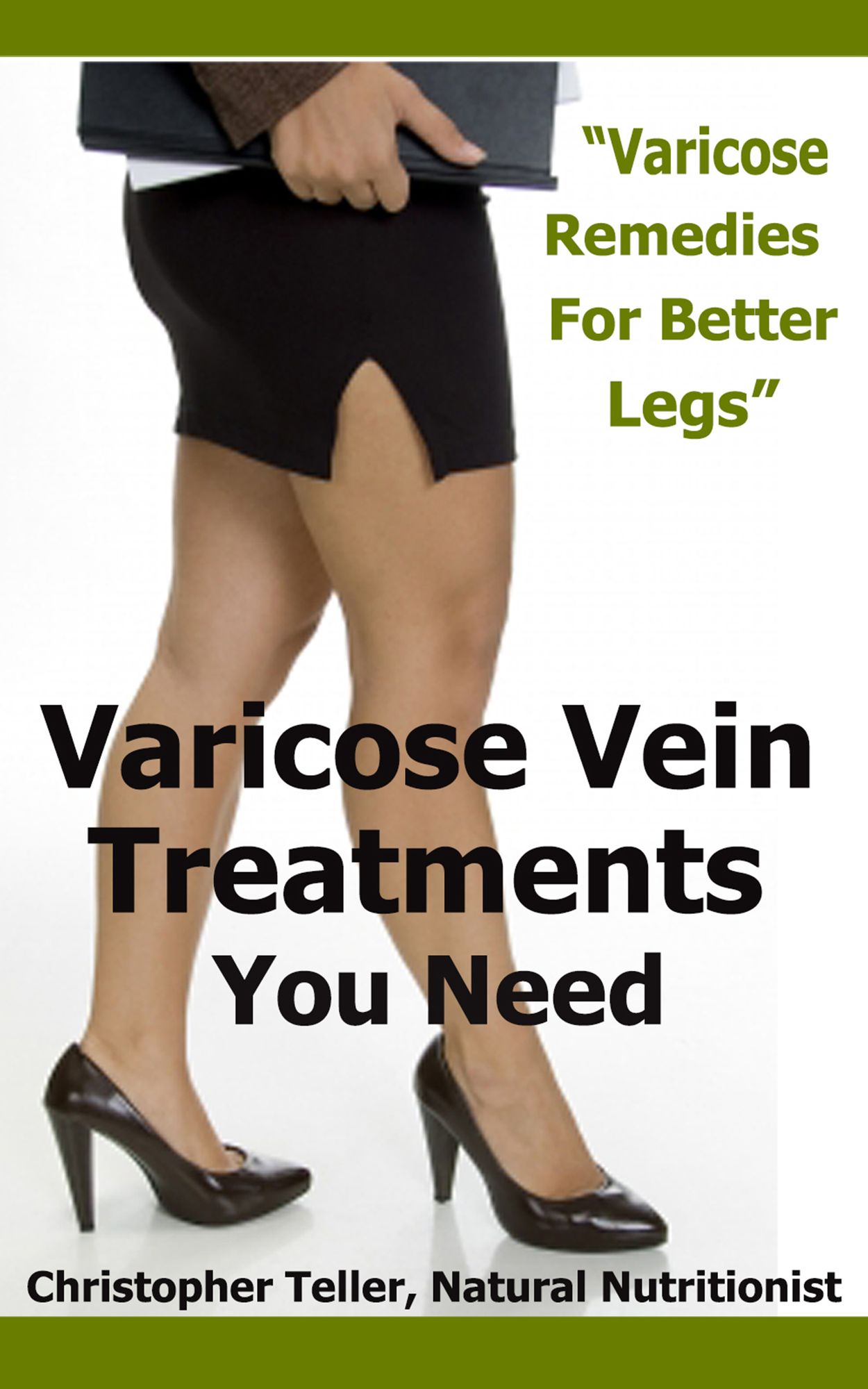Varicose Vein Treatments You Need: Varicose Remedies for Better Legs