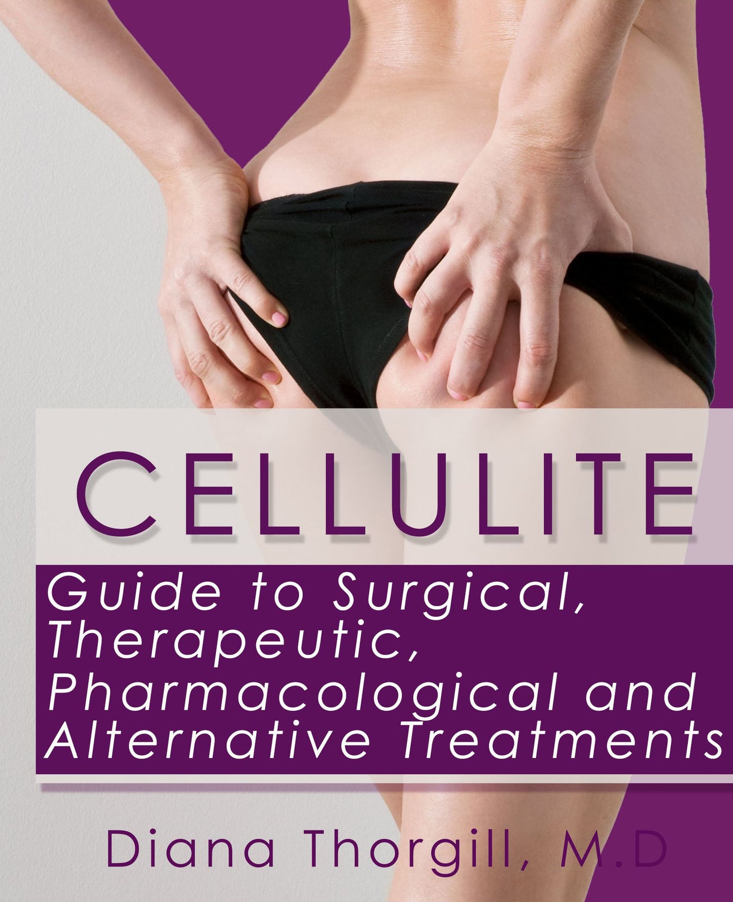 Cellulite: Guide to Surgical, Therapeutic, Pharmacological and Alternative Treatments