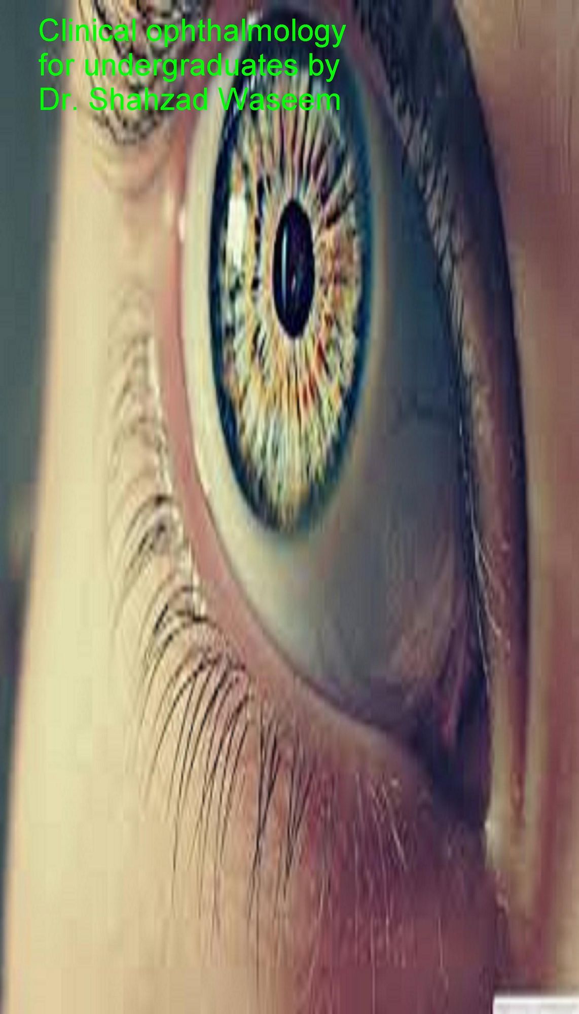 Clinical Ophthalmology for Undergraduates by Shahzad Waseem