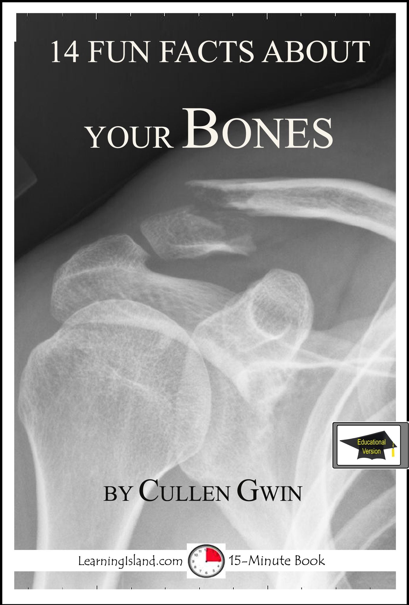 14 Fun Facts About Your Bones: Educational Version