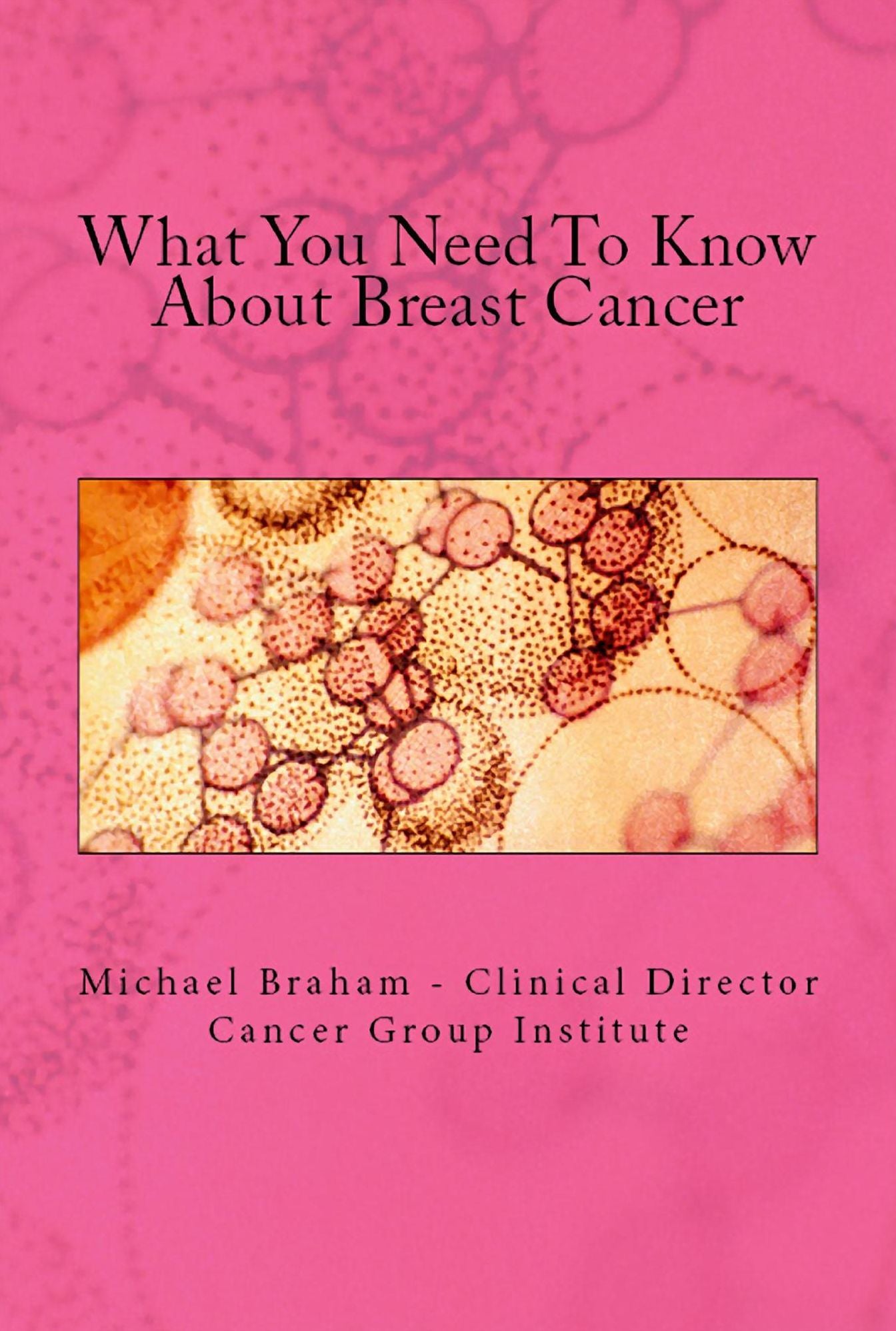 What You Need To Know About Breast Cancer