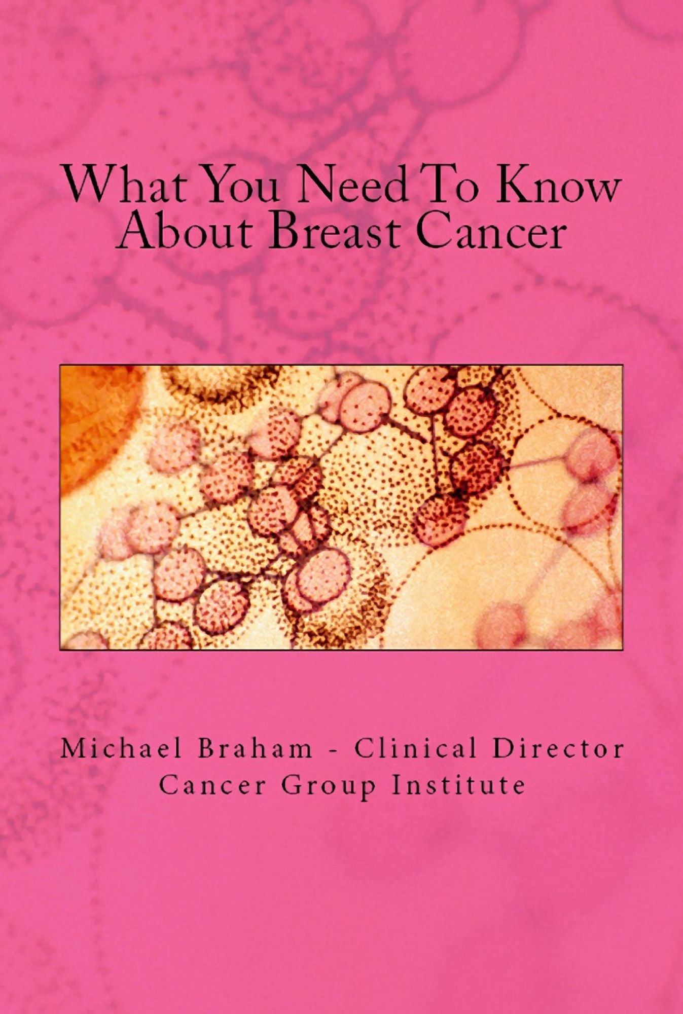What You Need To Know About Breast Cancer