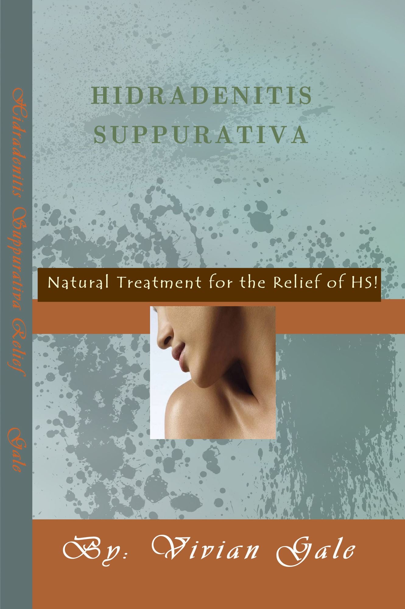 Hidradenitis Suppurativa, Natural Approaches for the Relief of HS