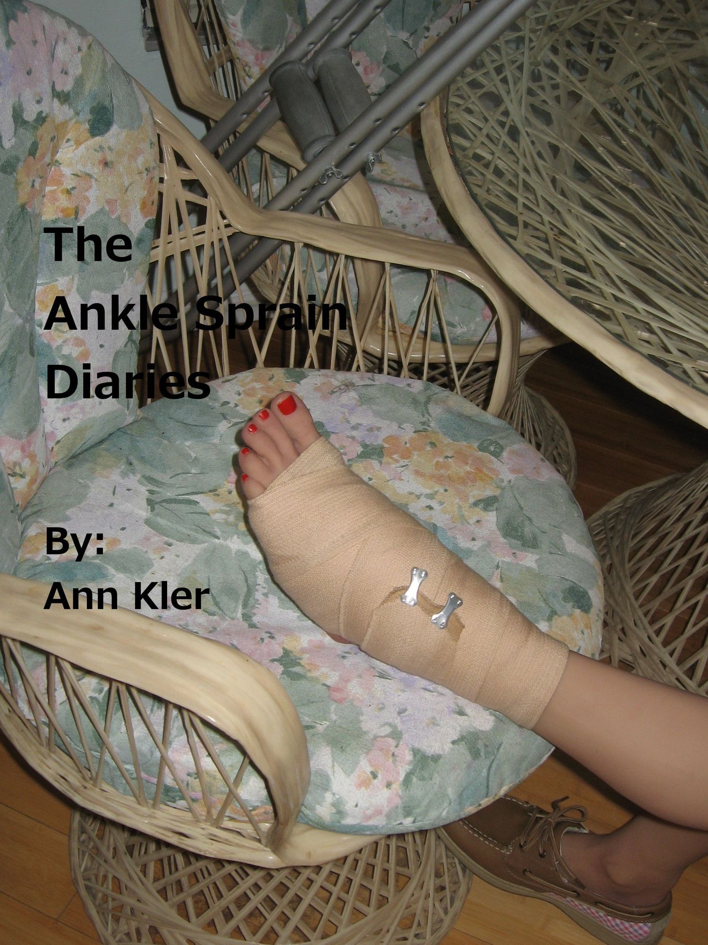 The Ankle Sprain Diaries