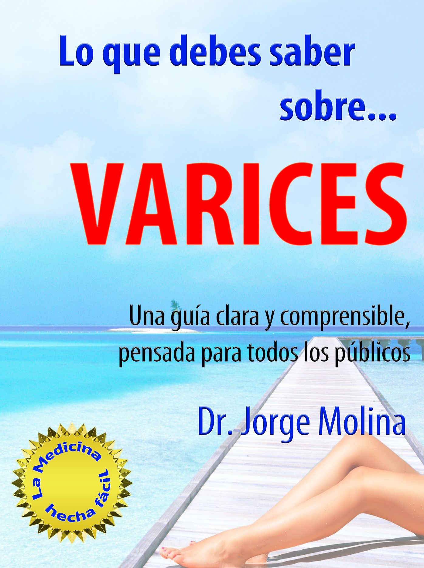 Lo que debes saber sobre... Varices